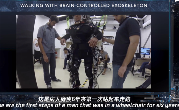 人兽杂交器官移植？这些研究有些科幻