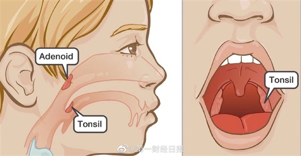 不明原因儿童急性肝炎最新发现 最新研究揭秘：非常严重
