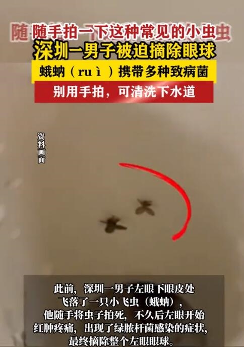 随手拍死蛾蚋 男子被迫摘除眼球:出现了绿脓杆菌感染症状